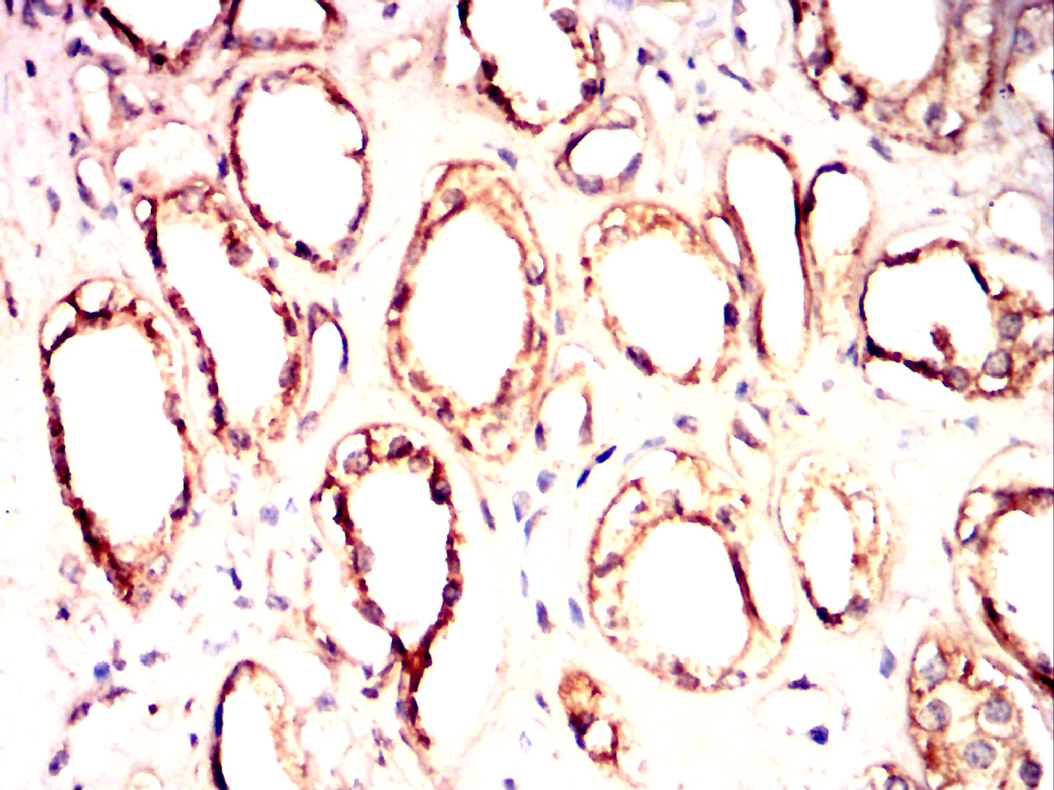 		IHC
